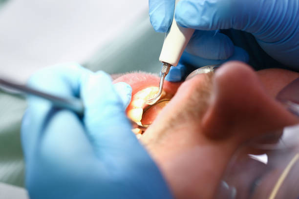 Best Same-Day Emergency Dentist in Anthony, TX