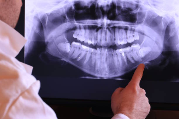 Best Emergency Dental Care for Trauma or Injury in Anthony, TX