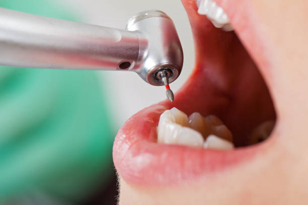 Best Walk-In Emergency Dentist in Anthony, TX
